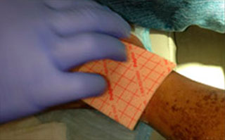 apply secondary dressing to wound